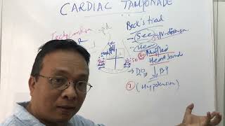 Cardiac Tamponade [upl. by Steddman237]