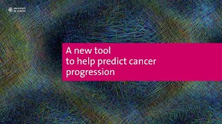 A new tool to help predict cancer progression [upl. by Ibor]