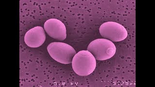 Saccharomyces Boulardii Helps With Diarrhea Irritable Bowel Syndrome Crohns Disease [upl. by Peh]