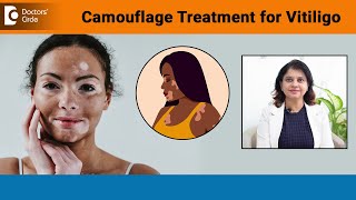 NEW VITILIGO TREATMENTCamouflage Treatment for Vitiligo Skin ColourDrAmee DaxiniDoctors Circle [upl. by Faires174]