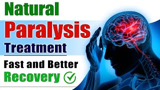 Natural Paralysis Treatment  Fast and Better Recovery  Brain Stroke Recovery  Dr Puru Dhawan [upl. by Laband]