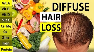 Nutritional Deficiencies Linked to Diffuse Hair Loss Evidence Based vs Myths [upl. by Coplin]