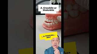 🤔Unveiling the Bite Types Find out YOUR dominant Chomping Pattern shorts dentallan bite teeth [upl. by Winnah]