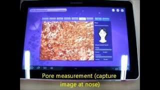 skin analysis application using MSS wireless scope skin scalp or hair analysis [upl. by Yendroc]