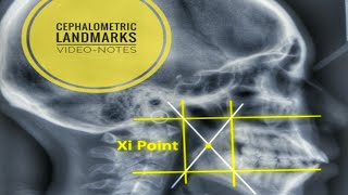 Cephalometric Landmarks and their definition [upl. by Onifur349]