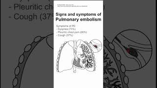 Signs and symptoms of Pulmonary embolism [upl. by Guy]