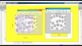 Detection of Malaria Parasites Using Digital Image Processing matlab projects [upl. by Stanfield]