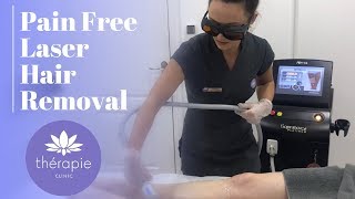 Pain Free Laser Hair Removal  Thérapie Clinic [upl. by Llewon684]