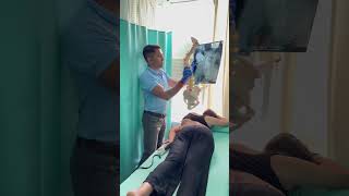 Most challenging scoliosis case treatment by DrRavi scoliosis chiropractic spine shorts reels [upl. by Ameehsat]