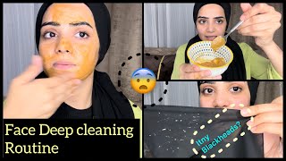 This Is How I Remove My Blackheads On Face  💯 Live Results Dietitian Aqsa [upl. by Convery]