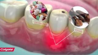 How Colgate Pain Out Works [upl. by Eluk811]