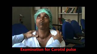 clinical examination of Goitre Thyroid examination Thyrotoxicosis [upl. by Nylrak290]