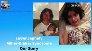 Lissencephaly and Grace Our Story [upl. by Kuo728]