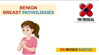 Benign Breast Pathologies [upl. by Leake]