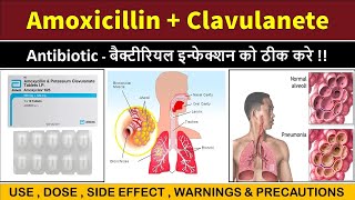 amoxicilline and potassium clavulanete  amoxyclav 625  cipmox cv 625 [upl. by Kari]