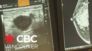 Doctors patients concerned about lack of breast cancer screening ultrasounds in BC [upl. by Teodoro]