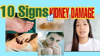 10 Sintomas Ng Kidney Disease [upl. by Haduhey]