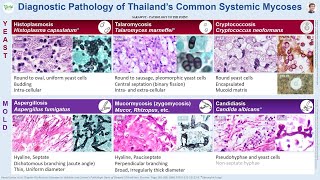 Patho Minutes Diagnostic Pathology of Thailands Common Systemic Mycoses [upl. by Harikahs]