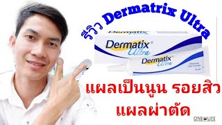 🌱🌿รีวิวการใช้ Dermatrix Ultra กับแผลเป็นนูน รอยสิว แผลผ่าตัด 🌿เภ💊สายเฮลท์🌾 [upl. by Yankee]