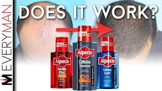 DOES CAFFEINE SHAMPOO WORK  Alpecin REVIEW amp Hair Growth Alternatives [upl. by Alyacim]