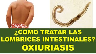 🔴 Lombrices intestinales que causan prurito perianal Oxiuriasis Síntomas Tratamiento y Prevención [upl. by Bernard]