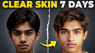 7 రోజుల్లో Clear Skin  10x Glow ✨ Tips for Naturally Glowing Skin and Home Remedies [upl. by Eki]