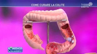 Come curare la colite [upl. by Naquin]