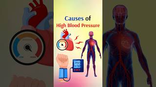 Causes of High Blood Pressure shorts [upl. by Amandy728]