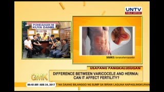 Varicocele VS Hernia  Can it affect fertility  Usapang Pangkalusugan [upl. by Wyne]