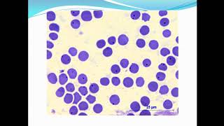 Rickettsial diseasesAnaplasmosis and Q fever ppt [upl. by Bouzoun]