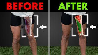 How To Fix Your Tight Groin In 1 Easy Exercise [upl. by Ronile]