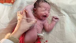 Breech delivery of beautiful newborn baby viral baby [upl. by Aitital411]