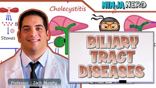 Biliary Tract Diseases  Clinical Medicine [upl. by Hildagard220]