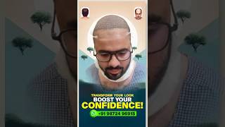 Best Hair Transplant clinic  How to stop Hairfall hair hairtransplant newvideo youtubeshorts [upl. by Horter235]