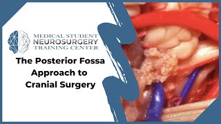 The Posterior Fossa Approach to Cranial Surgery [upl. by Landre]