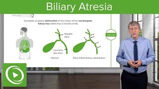 Biliary Atresia – Pediatrics  Lecturio [upl. by Kassia]