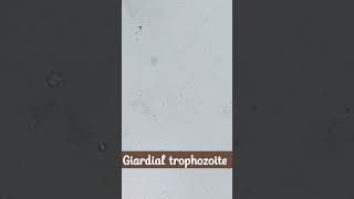 Microscopic identification of Giardia lamblia  cysts and trophozoite [upl. by Inga]