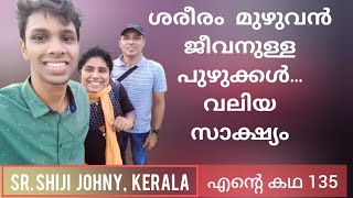 16 വർഷം വ്രണങ്ങൾ ആയി കിടക്കയിൽ കഴിയേണ്ടി വന്ന അനുഭവം Sr Shiji Johny Kerala Testimony [upl. by Gaynor]