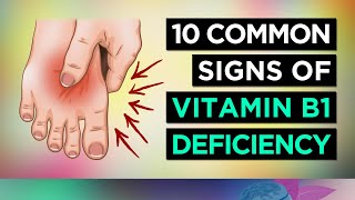 10 Signs You Are DEFICIENT in VITAMIN B1 Thiamine [upl. by Mignonne]