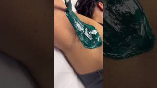 Professional underarm wax using Starpil hard wax in blue waxing esthetician [upl. by Ahsienod]