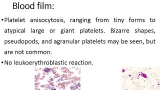 Essential Thrombocythemia [upl. by Sirrom]