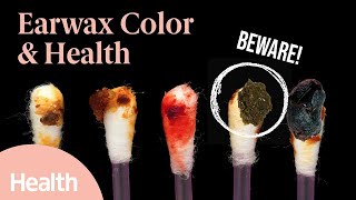 Your Earwax Reveals WHAT About Your Health Heres What Your Earwax Color Could Mean  Deep Dives [upl. by Macnamara]