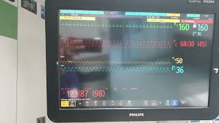 Fluke Prosim 8 Philips MX800 amp X3 with Neonatal Manikin [upl. by Rusert539]