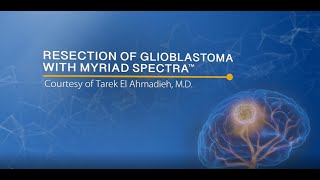 Glioblastoma Resection with Myriad SPECTRA Kimberly Hoang [upl. by Darraj]