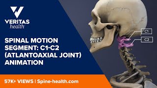 Flexion Distraction Injury Of The lumbar Spine  Everything You Need To Know  Dr Nabil Ebraheim [upl. by Vanhook]