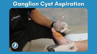 Ganglion Cyst Aspiration [upl. by Gaulin]