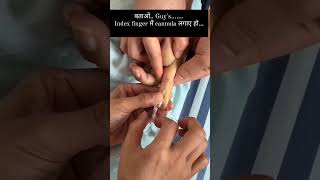 Index Finger in Cannula [upl. by Delwin]