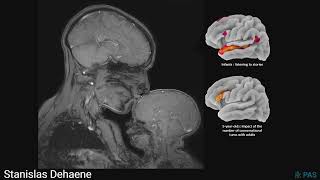 Stanislas Dehaene – Seeing the mind 35 years of progress in brain imaging [upl. by Aicelf]