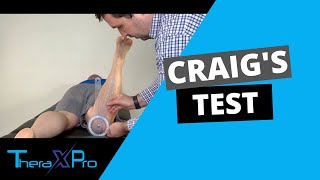 Craigs Test  Femoral Anteversion  Femoral Retroversion [upl. by Aneehta]