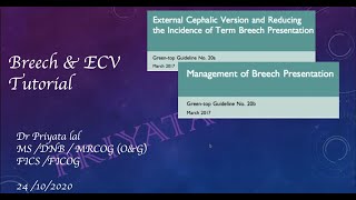 Assisted breech delivery and External Cephalic Version [upl. by Nellir]